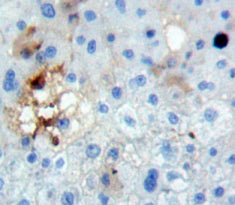 Epidermal Growth Factor Receptor (EGFR) Polyclonal Antibody - image 5