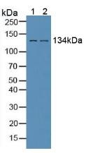 Western Blot; Sample: Recombinant EGFR2, Human.