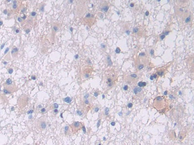 DAB staining on IHC-P; Samples: Human Pancreas Tissue.