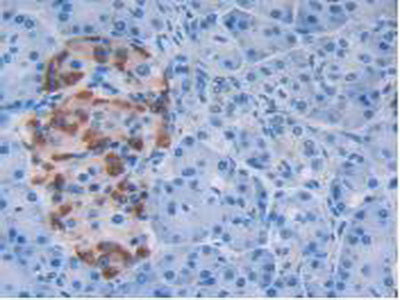 Epidermal Growth Factor Receptor (EGFR) Polyclonal Antibody - image 5