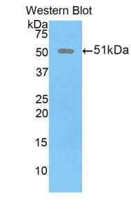 DAB staining on IHC-P; Samples: Rat Uterus Tissue;  Primary Ab: 20μg/ml Rabbit Anti-Rat DKK1 Antibody Second Ab: 2µg/mL HRP-Linked Caprine Anti-Rabbit IgG Polyclonal Antibody