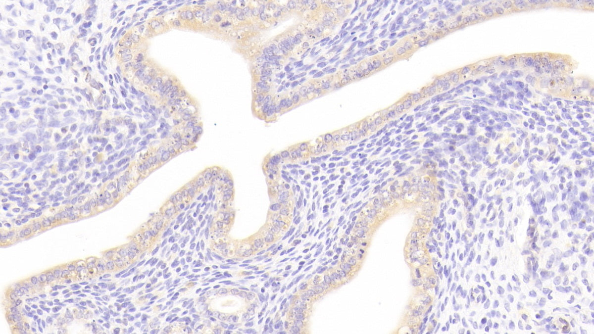 Dickkopf Related Protein 1 (DKK1) Polyclonal Antibody - image 4
