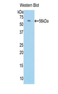 Protein C (PROC) Polyclonal Antibody - image 2