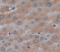 Protein C (PROC) Polyclonal Antibody - image 3