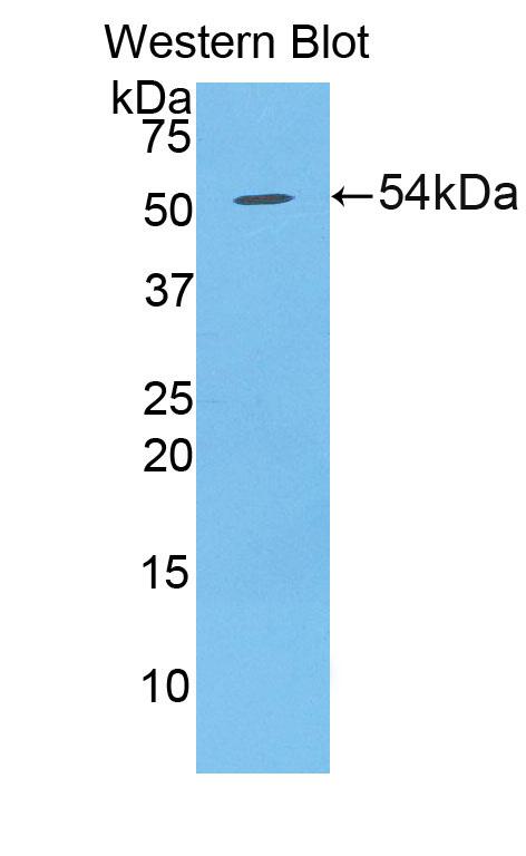Desmoglein 1 (DSG1) Polyclonal Antibody - image 2