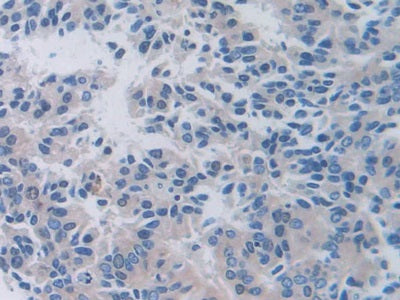 DAB staining on IHC-P; Samples: Human Liver Tissue.