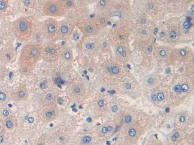 Prealbumin (PALB) Polyclonal Antibody - image 5