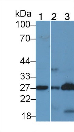 DAB staining on IHC-P; Samples: Human Kidney Tissue; Primary Ab: 10µg/ml Rabbit Anti-Human PGD2S Antibody Second Ab: 2µg/mL HRP-Linked Caprine Anti-Rabbit IgG Polyclonal Antibody