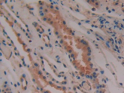 DAB staining on IHC-P; Samples: Human Kidney Tissue