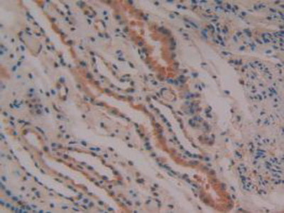 Prostaglandin-H2 D-isomerase (PTGDS) Polyclonal Antibody - image 5