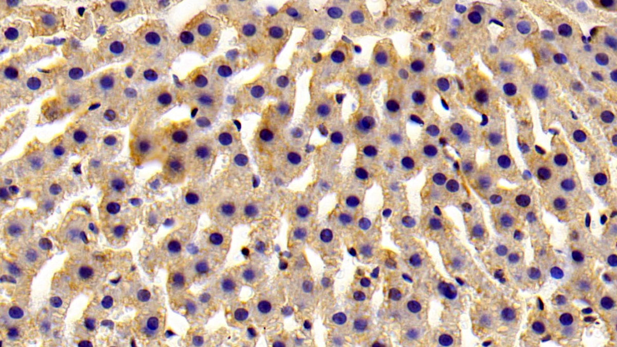 ADP Ribosyltransferase 4 (ART4) Polyclonal Antibody - image 3