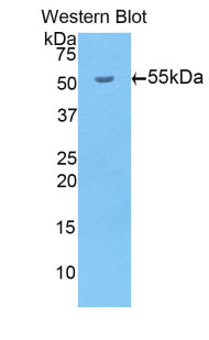 Beta-Site APP Cleaving Enzyme 1 (bACE1) Polyclonal Antibody - image 2