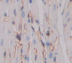 Beta-Site APP Cleaving Enzyme 1 (bACE1) Polyclonal Antibody - image 3