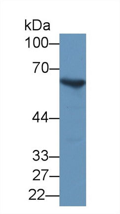 Western Blot; Sample: Mouse Lung lysate; Primary Ab: 1µg/ml Rabbit Anti-Mouse G6PD Antibody Second Ab: 0.2µg/mL HRP-Linked Caprine Anti-Rabbit IgG Polyclonal Antibody