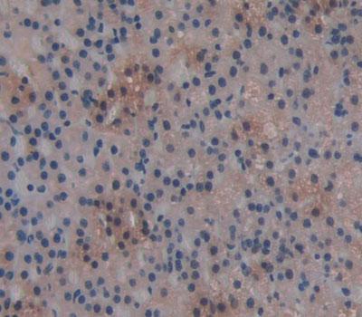 Glucose-6-phosphate Dehydrogenase (G6PD) Polyclonal Antibody - image 4