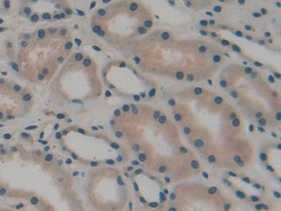 DAB staining on IHC-P; Samples: Human Prostate Gland Tissue.