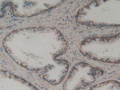 Sodium/potassium Transporting ATPase Subunit Beta-3 (ATP1b3) Polyclonal Antibody - image 5