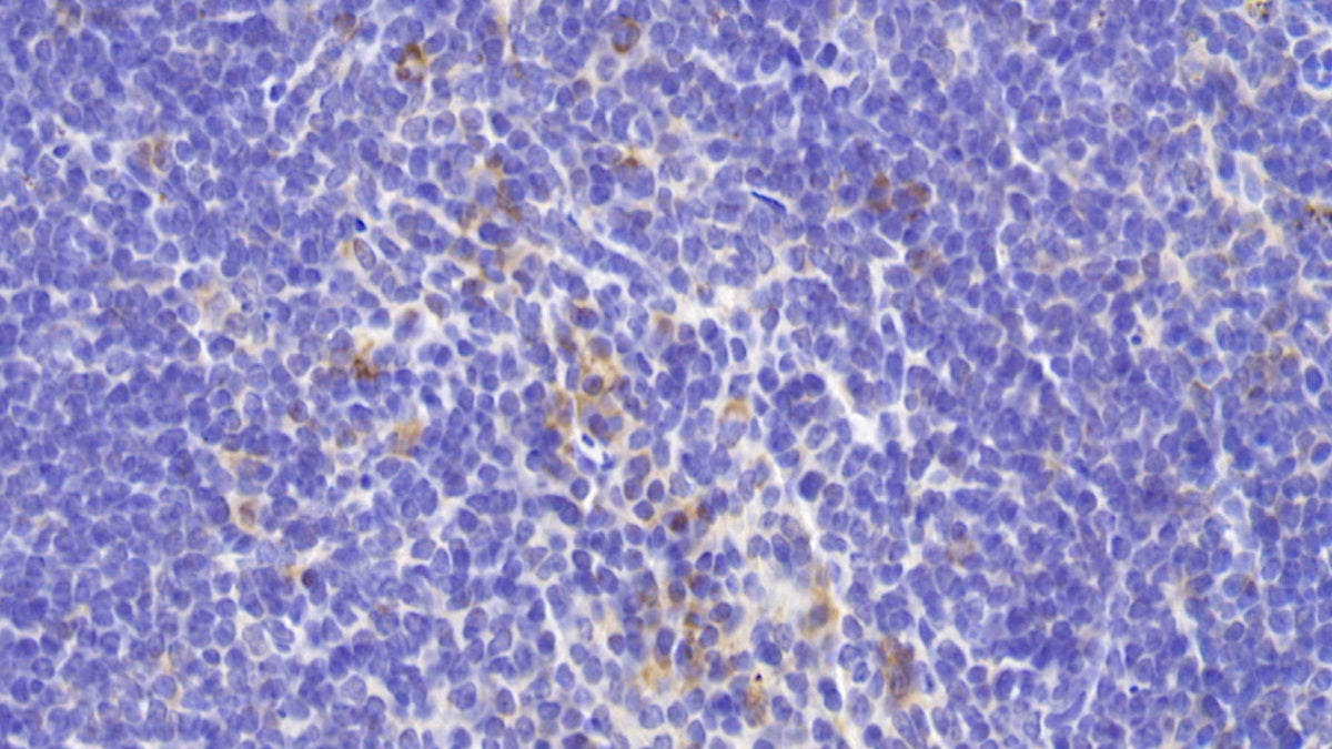 DAB staining on fromalin fixed paraffin-embedded spleen tissue)