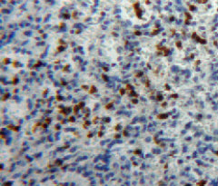 Heparanase (HPSE) Polyclonal Antibody - image 5
