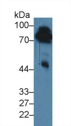 DAB staining on IHC-P; Samples: Mouse Liver Tissue;  Primary Ab: 10µg/ml Rabbit Anti-Mouse F1+2 Anti