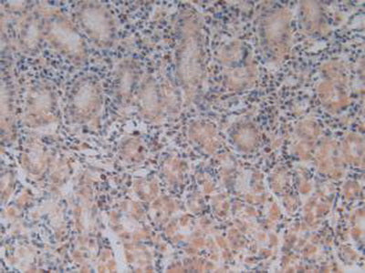 Toll Like Receptor 9 (TLR9) Polyclonal Antibody - image 5