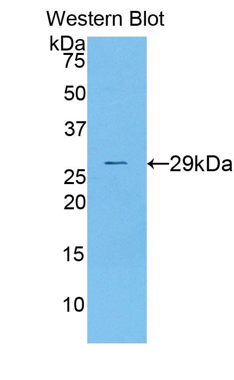 DAB staining on IHC-P; Samples: Mouse Kidney Tissue; Primary Ab: 20μg/ml Rabbit Anti-Mouse DLAT Antibody Second Ab: 2µg/mL HRP-Linked Caprine Anti-Rabbit IgG Polyclonal Antibody