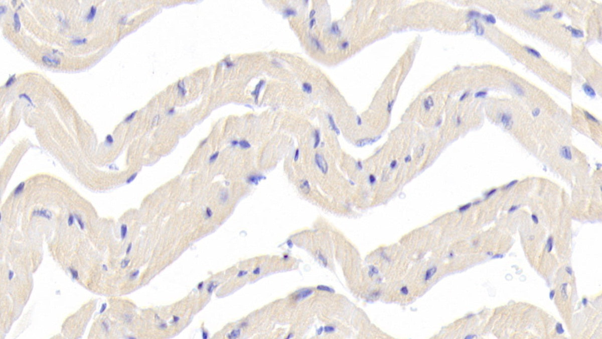 Dihydrolipoyl Transacetylase (DLAT) Polyclonal Antibody - image 5