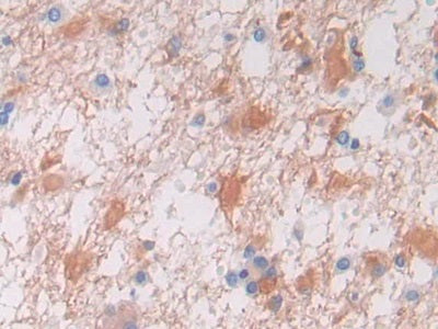 DAB staining on fromalin fixed paraffin-embedded Intestine tissue)