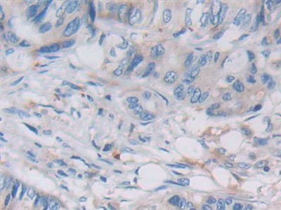 Von Willebrand Factor A Domain Containing Protein 3A (vWA3A) Polyclonal Antibody - image 5