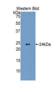 DAB staining on IHC-P;<br/>Samples: Human Cardiac Muscle Tissue; <br/>Primary Ab: 20μg/ml Rabbit Anti-Human Hsp27 Antibody<br/>Second Ab: 2µg/mL HRP-Linked Caprine Anti-Rabbit IgG Polyclonal Antibody<br/>