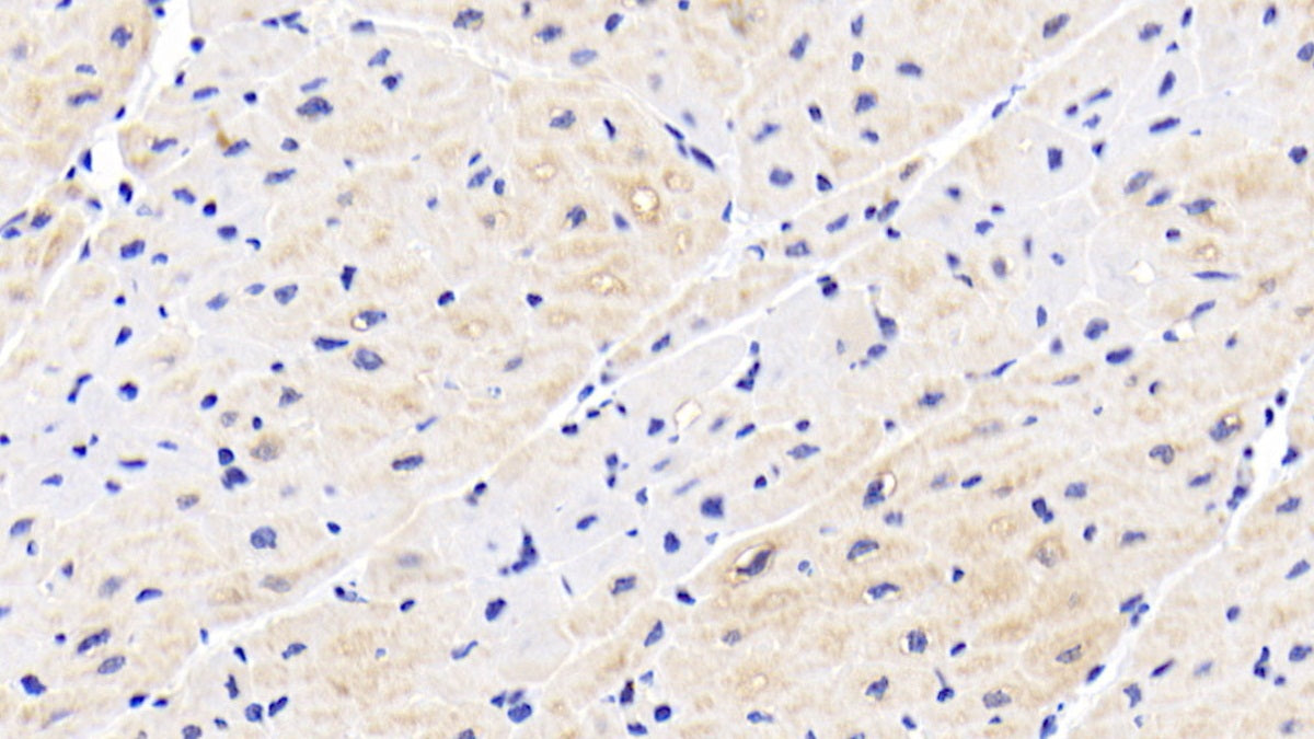 DAB staining on fromalin fixed paraffin-embedded Brain tissue)