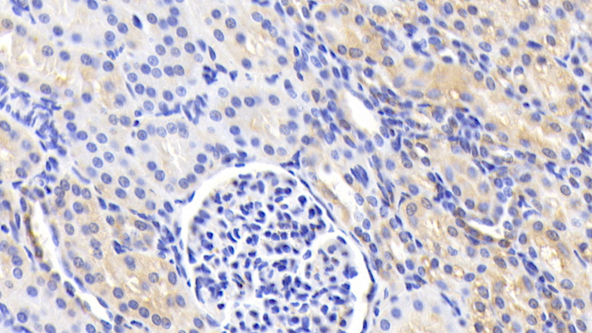 Heat Shock Protein 27 (Hsp27) Polyclonal Antibody - image 5