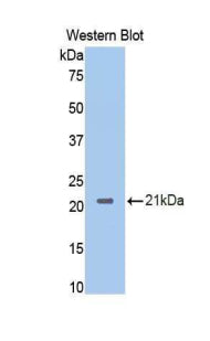Neuropilin 1 (NRP1) Polyclonal Antibody - image 2
