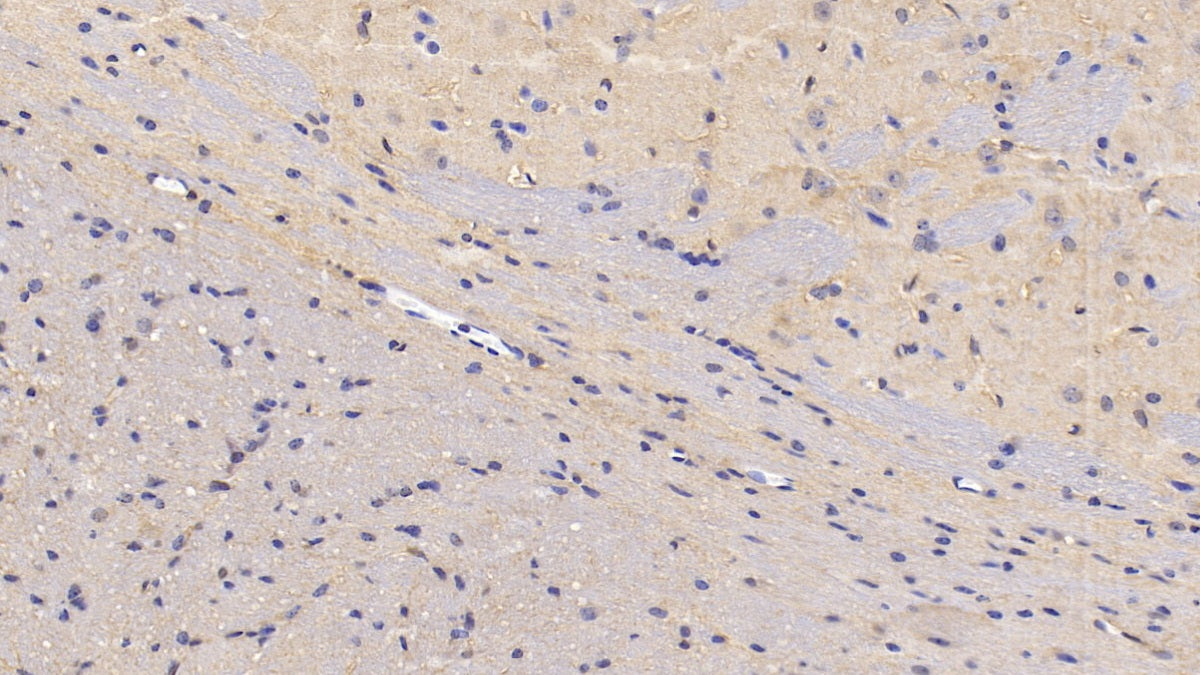 DABstainingonIHC-P.Samples:MouseTissue)