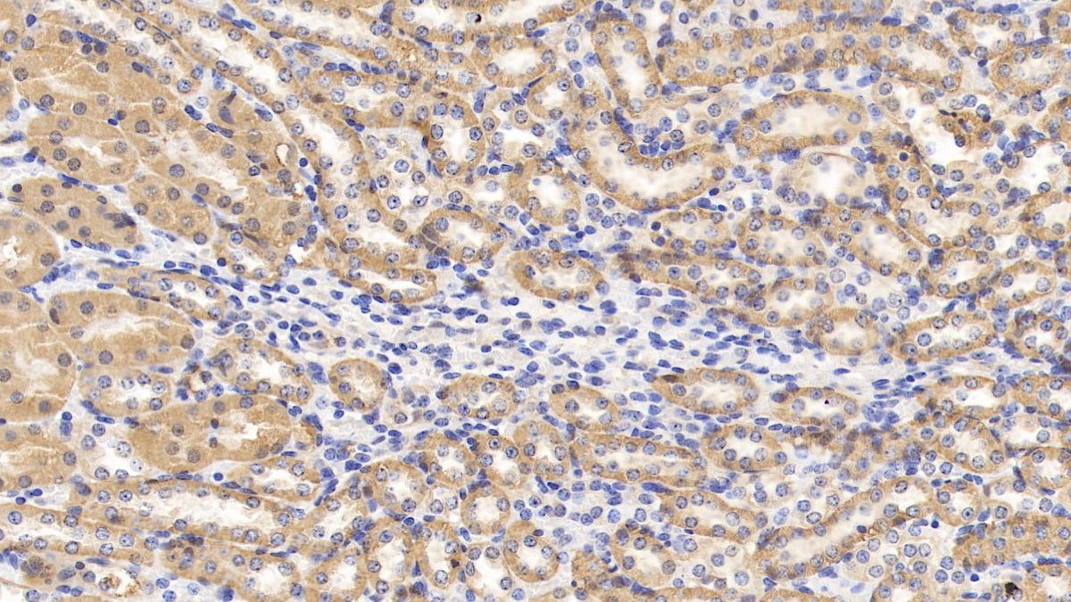 Neuropilin 1 (NRP1) Polyclonal Antibody - image 4
