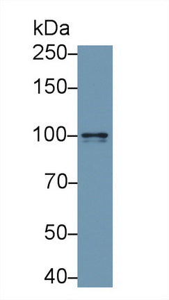 Western Blot; Sample: Recombinant protein.
