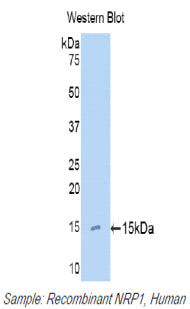 DAB staining on IHC-P; Samples: Human Cardiac Muscle Tissue; Primary Ab: 20μg/ml Rabbit Anti-Human NRP1 Antibody Second Ab: 2µg/mL HRP-Linked Caprine Anti-Rabbit IgG Polyclonal Antibody