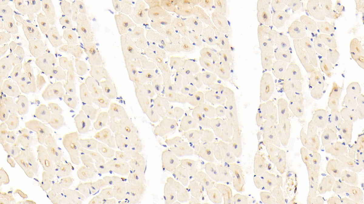 DAB staining on IHC-P; Samples: Human Kidney Tissue; Primary Ab: 20μg/ml Rabbit Anti-Human NRP1 Antibody Second Ab: 2µg/mL HRP-Linked Caprine Anti-Rabbit IgG Polyclonal Antibody