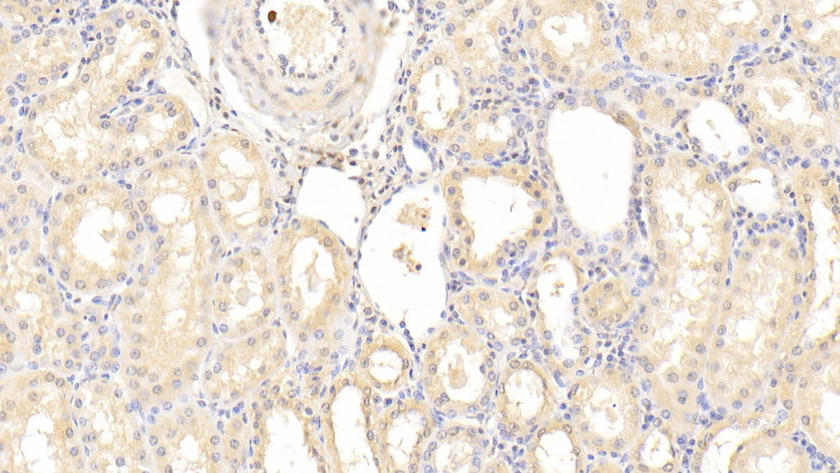 Neuropilin 1 (NRP1) Polyclonal Antibody - image 5
