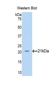 Neuropilin 1 (NRP1) Polyclonal Antibody - image 2