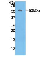 Kallikrein 6 (KLK6) Polyclonal Antibody - image 2