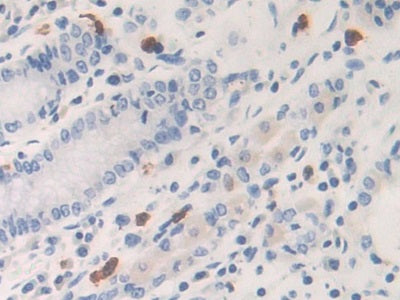 DAB staining on IHC-P; Samples: Human Prostate Gland Tissue
