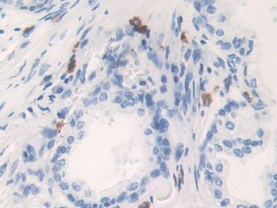 Kallikrein 6 (KLK6) Polyclonal Antibody - image 4