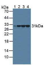 Western Blot; Sample: Recombinant calretinin, Human.