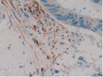 Calretinin (CR) Polyclonal Antibody - image 5