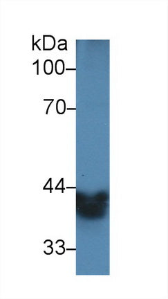Western Blot; Sample: Recombinant protein.