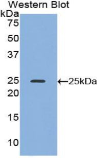 DAB staining on IHC-P; Samples: Mouse Liver Tissue;  Primary Ab: 20μg/ml Rabbit Anti-Mouse ADH1 Antibody Second Ab: 2µg/mL HRP-Linked Caprine Anti-Rabbit IgG Polyclonal Antibody