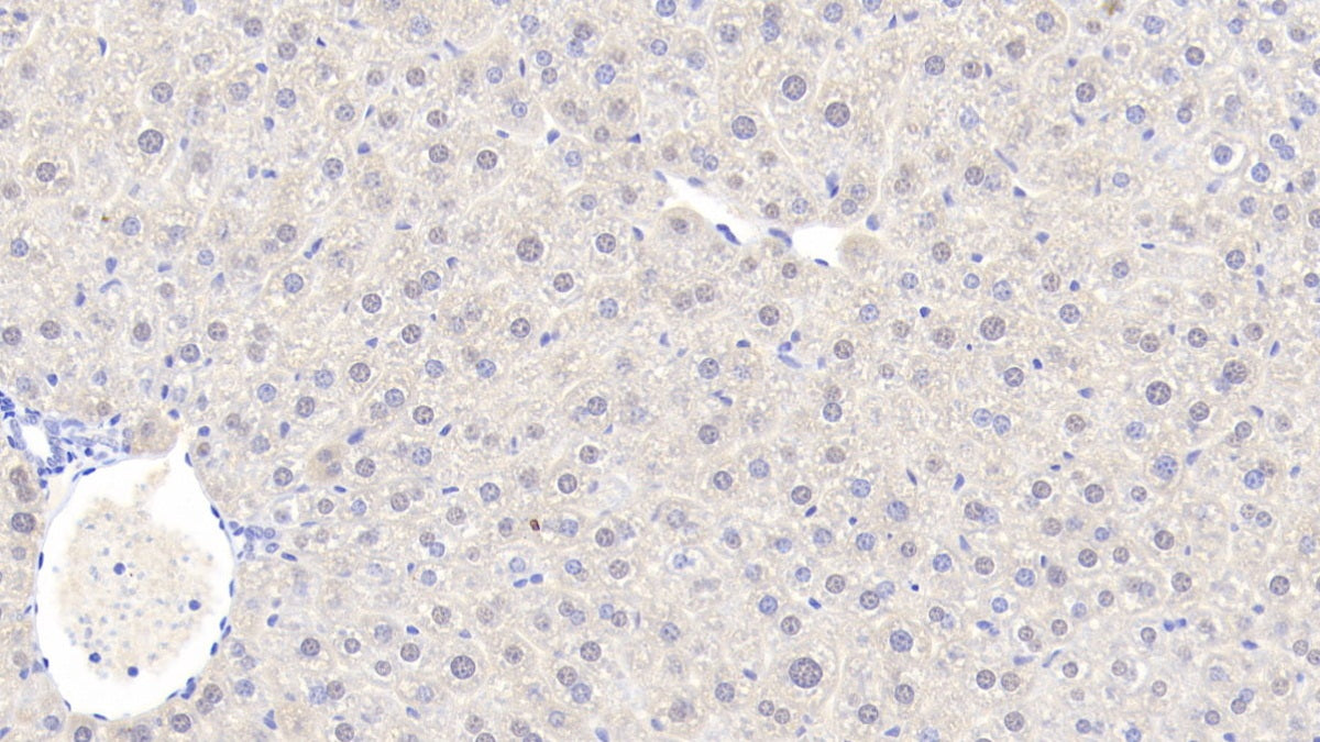 Alcohol Dehydrogenase 1 (ADH1) Polyclonal Antibody - image 4
