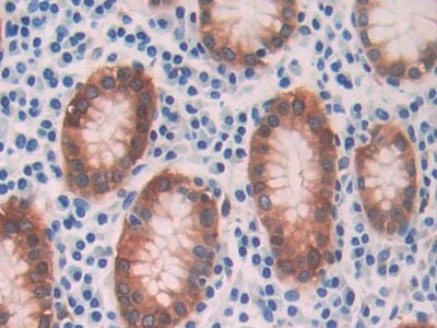 DAB staining on fromalin fixed paraffin-embedded Liver tissue)