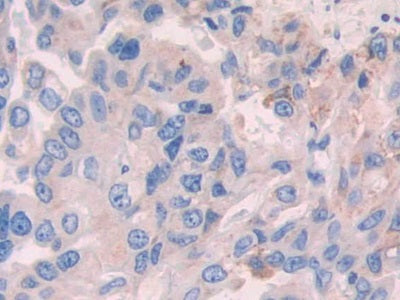 Alcohol Dehydrogenase 1 (ADH1) Polyclonal Antibody - image 5